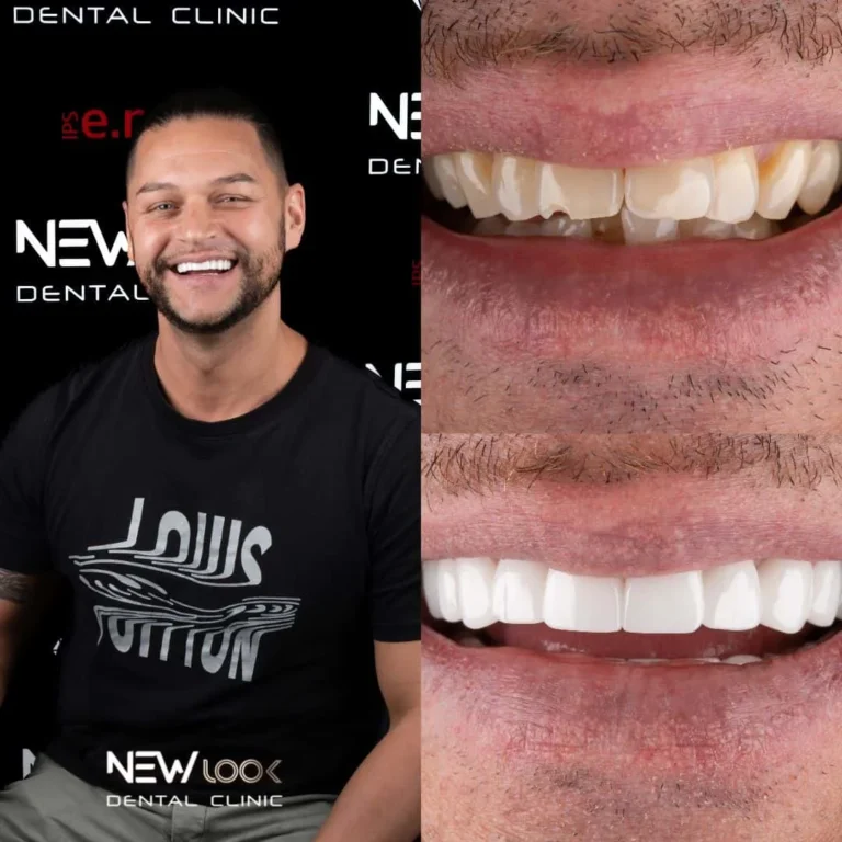 Dental Treatment Turkey