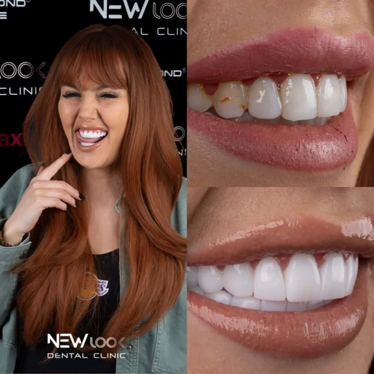 Dental Treatment Turkey