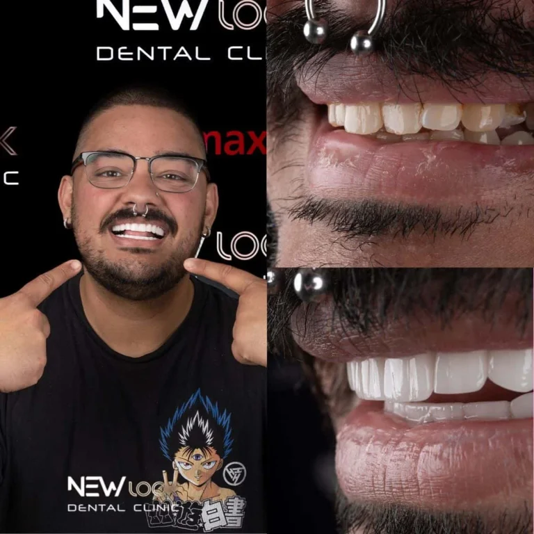 Dental Treatment Turkey